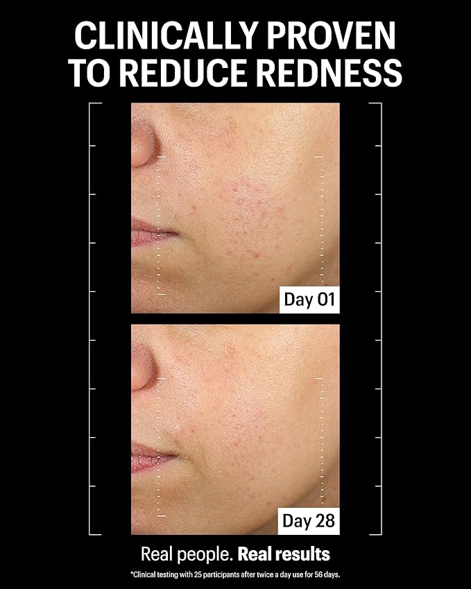 Allies of Skin Retinal 0.1% Peptides Repair Night Cream with 0.1% Encapsulated Retinal, 6 Peptides, 2% Ornithine & EGCG Complex, 8.7% Ceramides & Omegas Complex