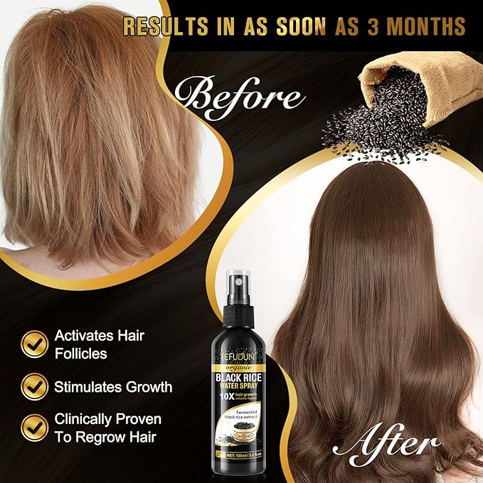 (3Pc) Organic Black Rice Water Spray for Hair Growth, A Solution with Castor Oil & Ginger Root Extract for Thicker, Fuller Hair, Targets Hair Loss and Repairs Damage 300ml/9.6 fl.oz