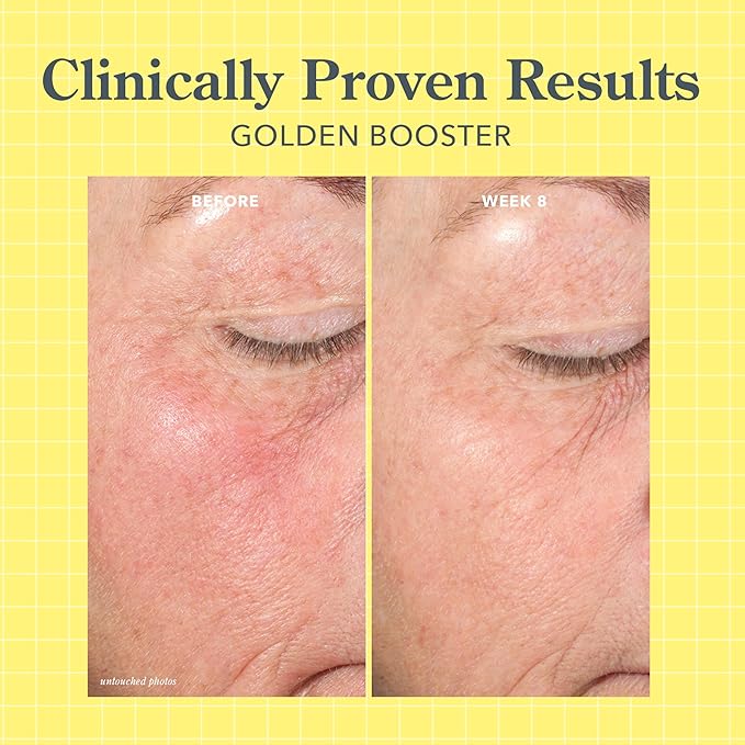 Beekman 1802 Golden Booster Amla Berry Face Serum - Fragrance Free - 1 fl oz - Plant-Based Vitamin C Alternative - Good for Sensitive Skin - Cruelty Free